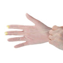 Shop online at Serona for the veterinary dental Keystone Vet Finger Light, which includes a dual LED finger light leads, two finger clips, and a wrist band.